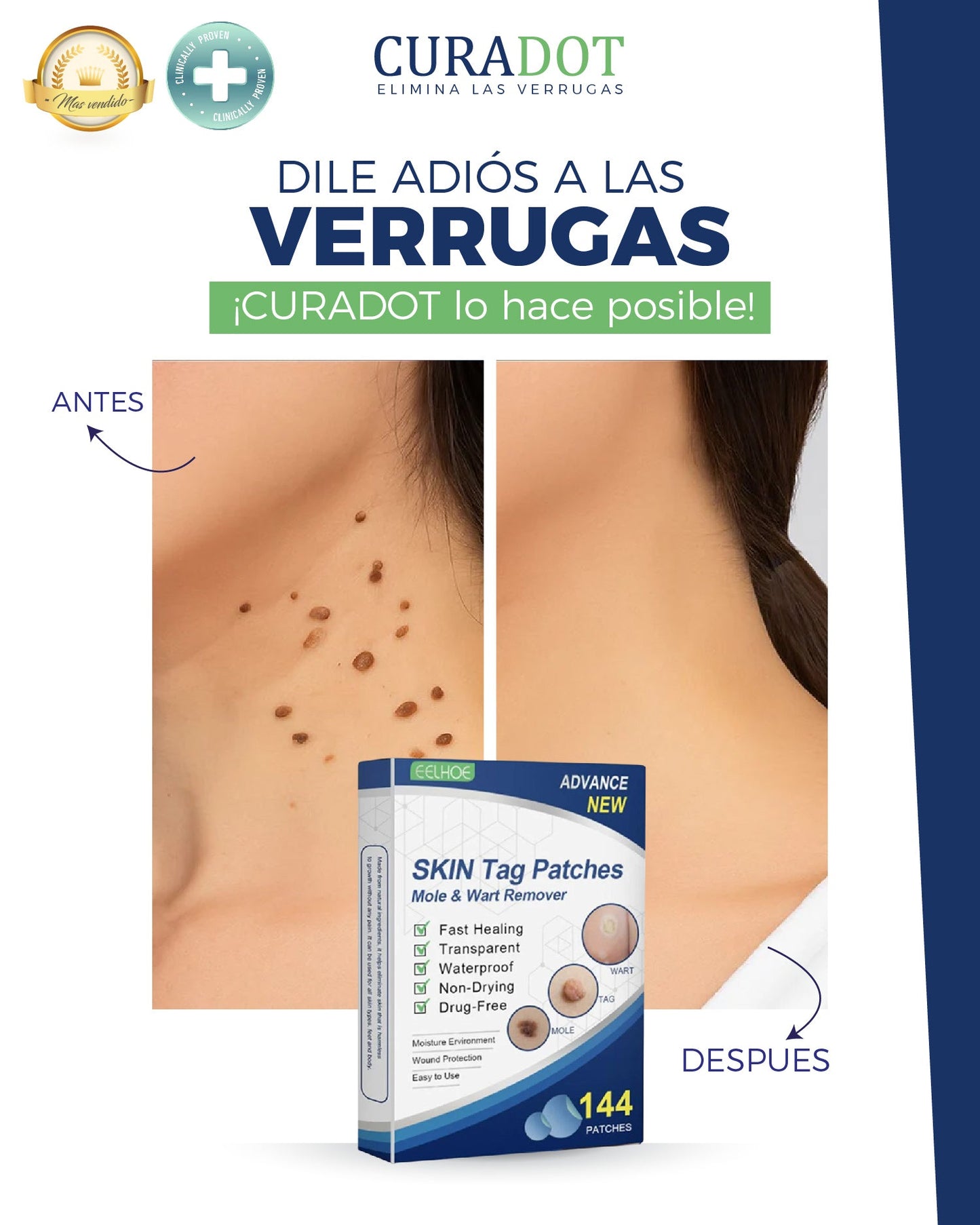 Parches Removedores De Lunares y Verrugas