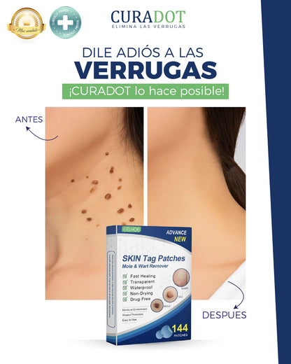 Parches Removedores De Lunares y Verrugas